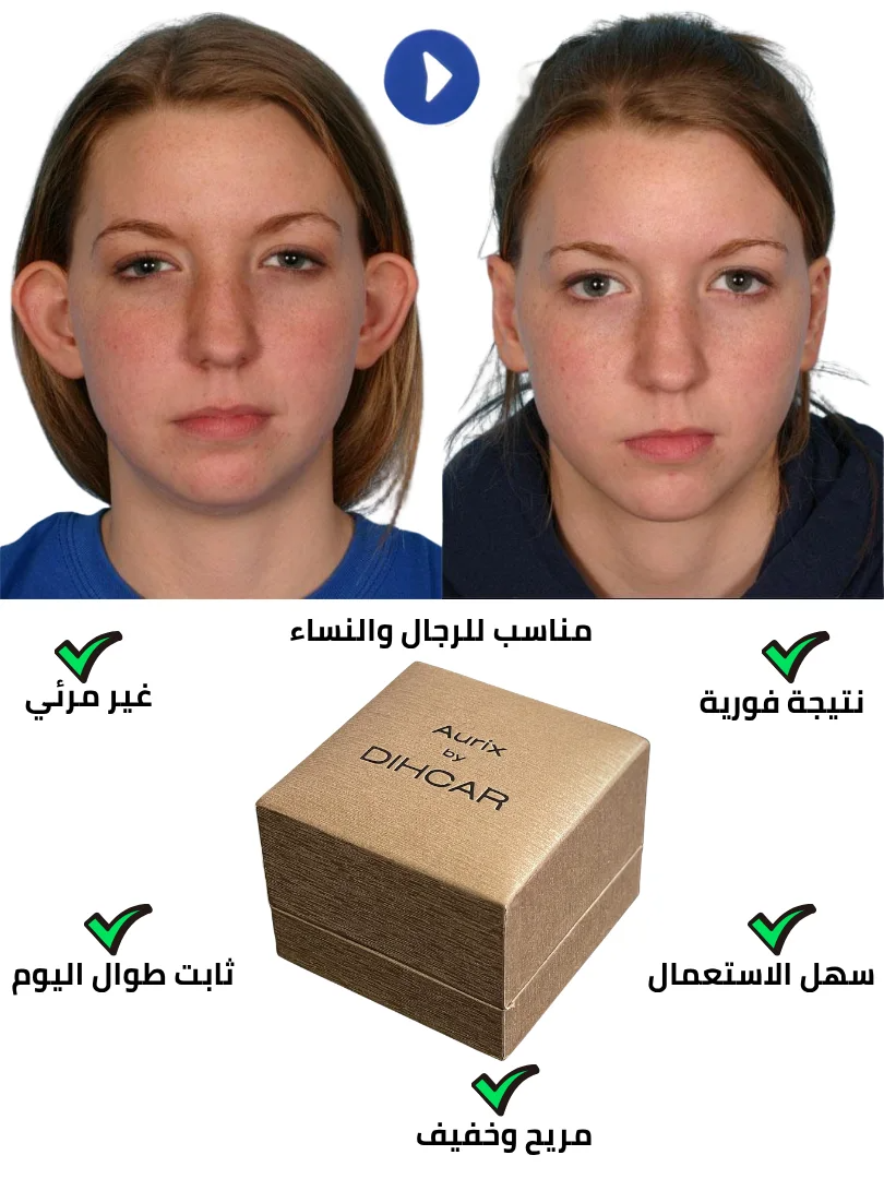 مصحّح الأذنين Aurix